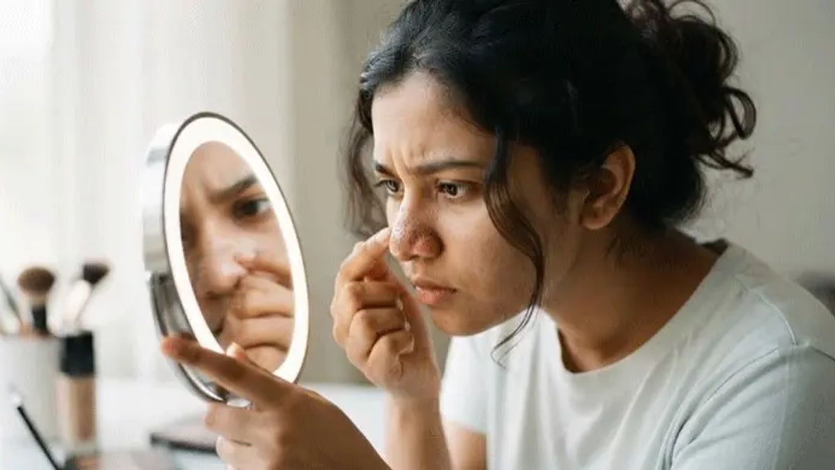 ব্ল্যাকহেডস কেন হয়, দূর করার সঠিক উপায় জানুন