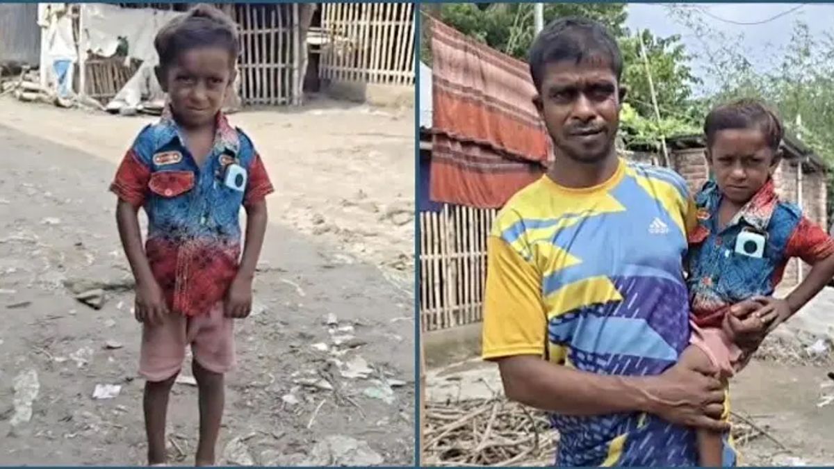 তিন বছরের শিশুর মতো দেখতে ১৭ বছরের ইয়াসিন, দুঃখই যেন তার জীবনসঙ্গী