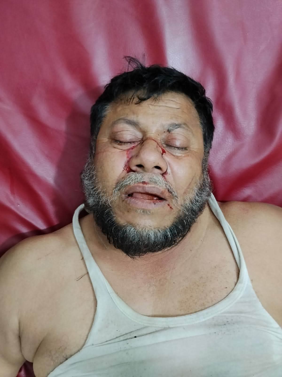 গাজীপুরে গজারী বনে প্রৌঢ়কে হত্যার চেষ্টা ও টাকা ছিনতাই, থানায় অভিযোগ