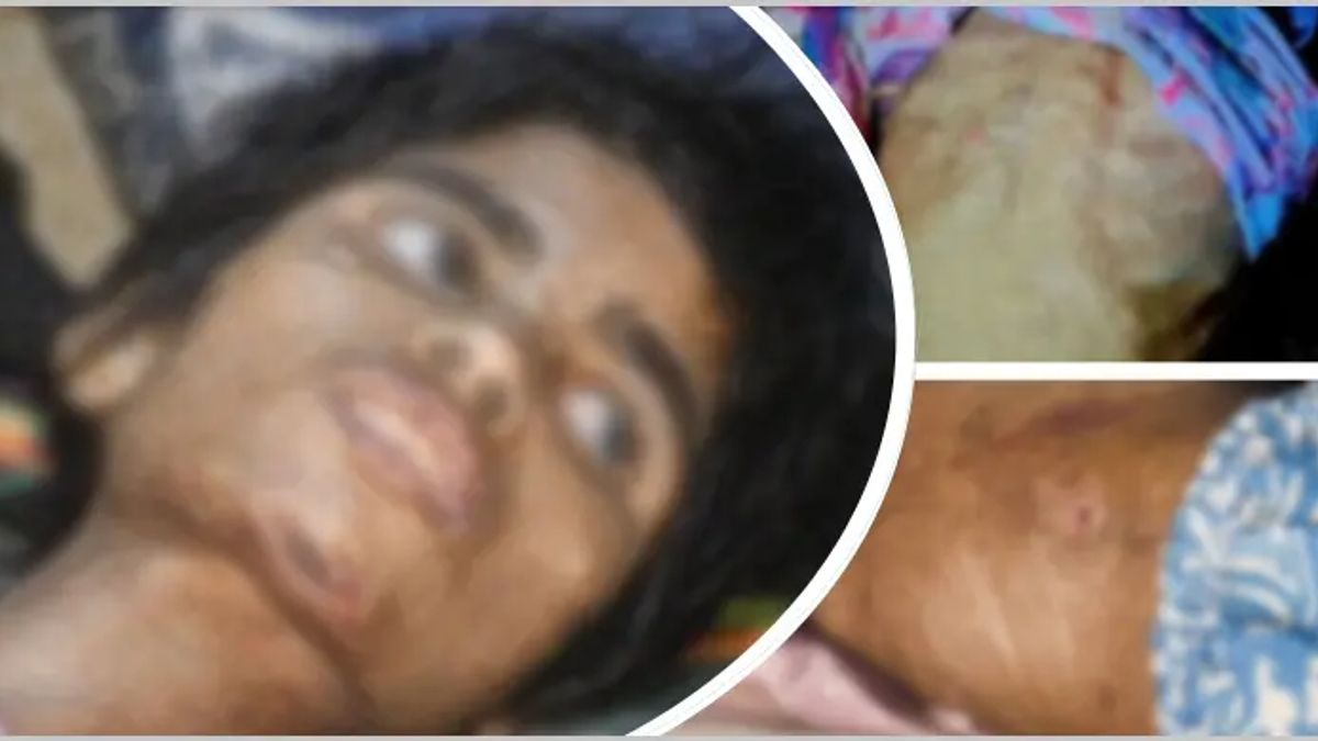 বাথরুমে বন্দি রাখা হতো শিশু তানিয়াকে, নির্যাতনে শরীরে পচন